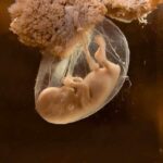 Pregnancy Bombshell Ignites Brutal Firestorm A translucent jellyfish embryo suspended in a fluid-filled sac