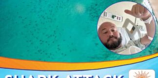Florida Man Recalls Terrifying 7-Foot Nurse Shark Bite Near Key West