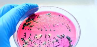 Gloved hand holding petri dish with bacterial colonies on pink agar